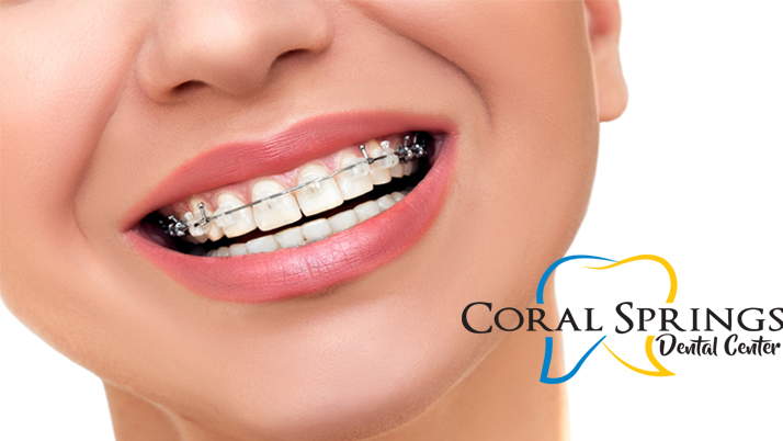 Orthodontist Coral Springs FL