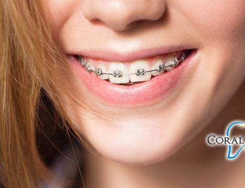 Orthodontists Coral Springs FL