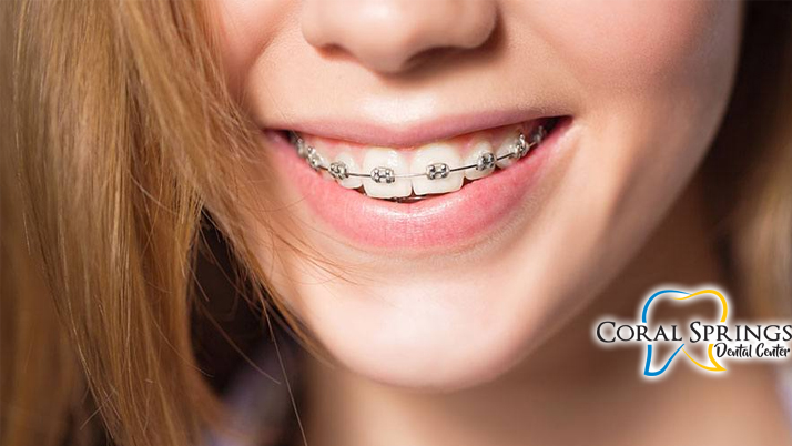 Orthodontists Coral Springs FL