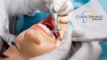Affordable Teeth Cleaning Coral Springs