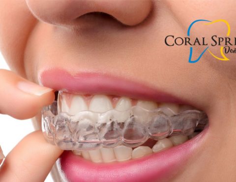 Invisalign Clear Braces Coral Springs